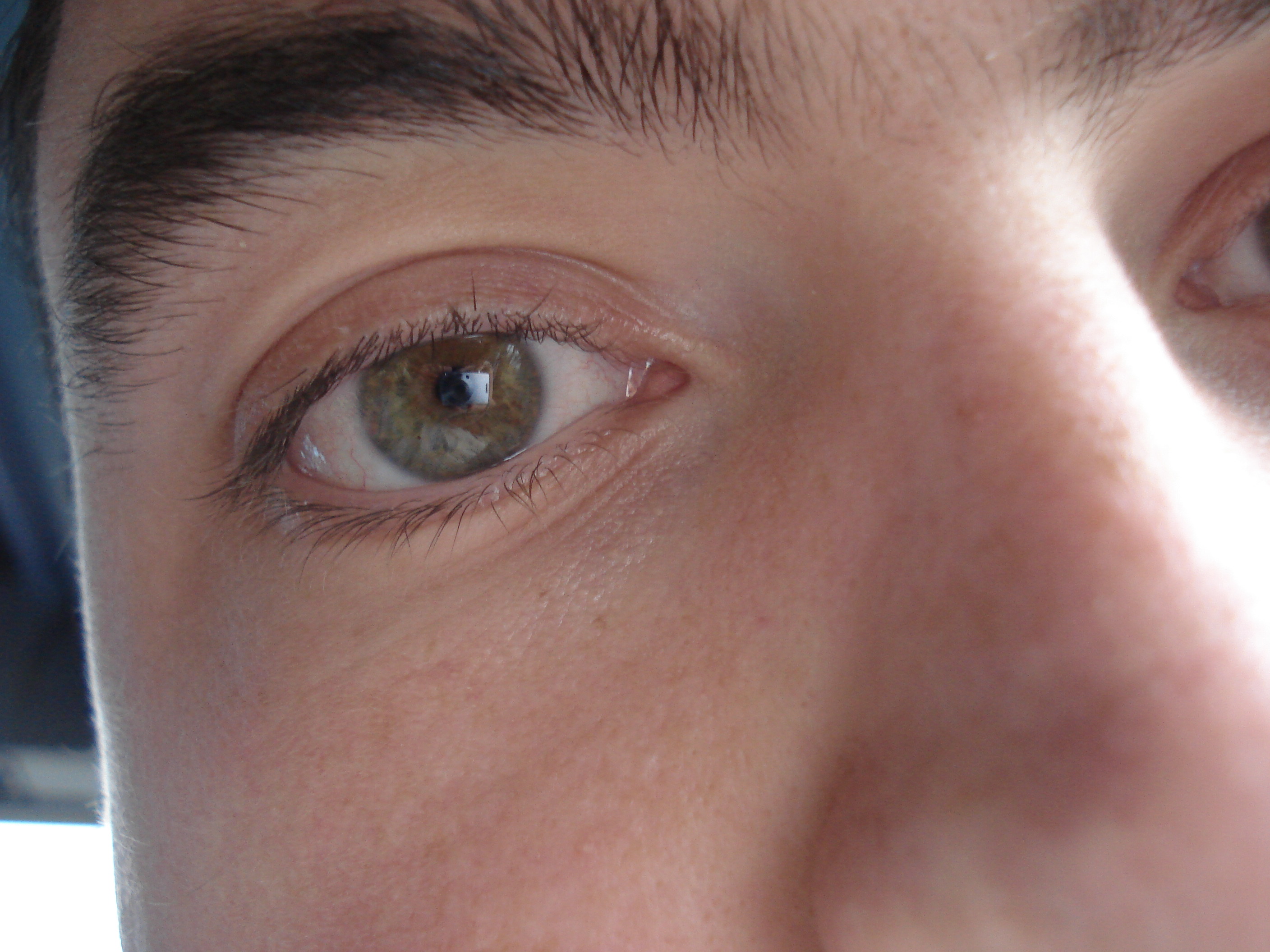 Eye