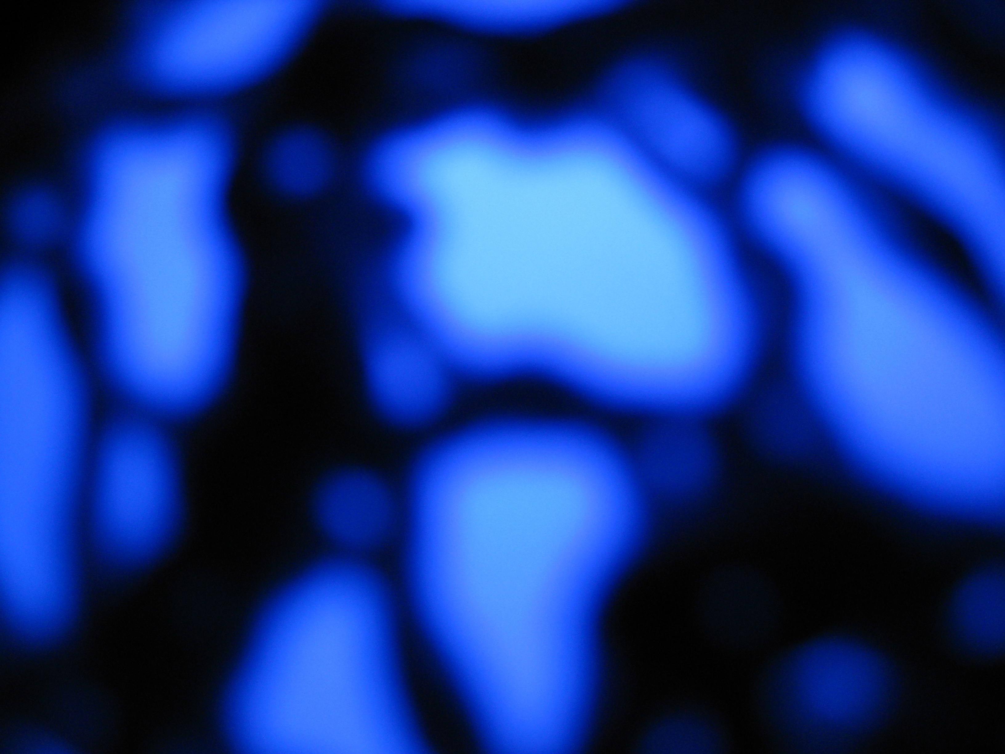 Sphere in chord netting