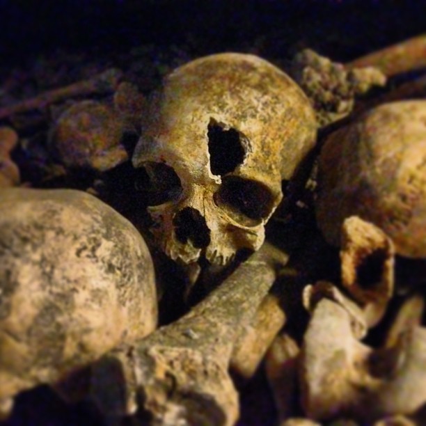 A skull with a large hole in the forehead sits amongst other skulls and bones.